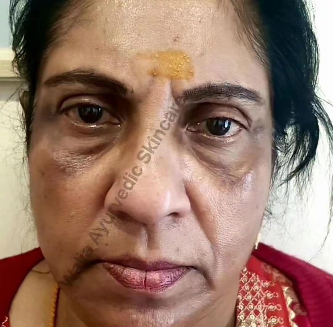 Waliaz Ayurvedic Skincare Facebook ad: SAT SRI AKAL JI