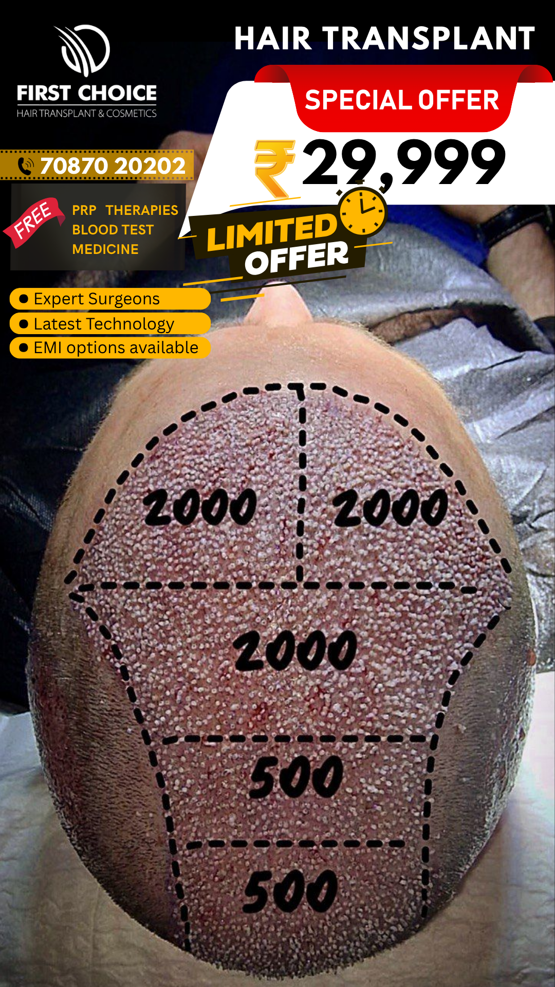First Choice Hair Transplant & Cosmetics Facebook ad: Get Your Hair Back, Natural Hair Transplant