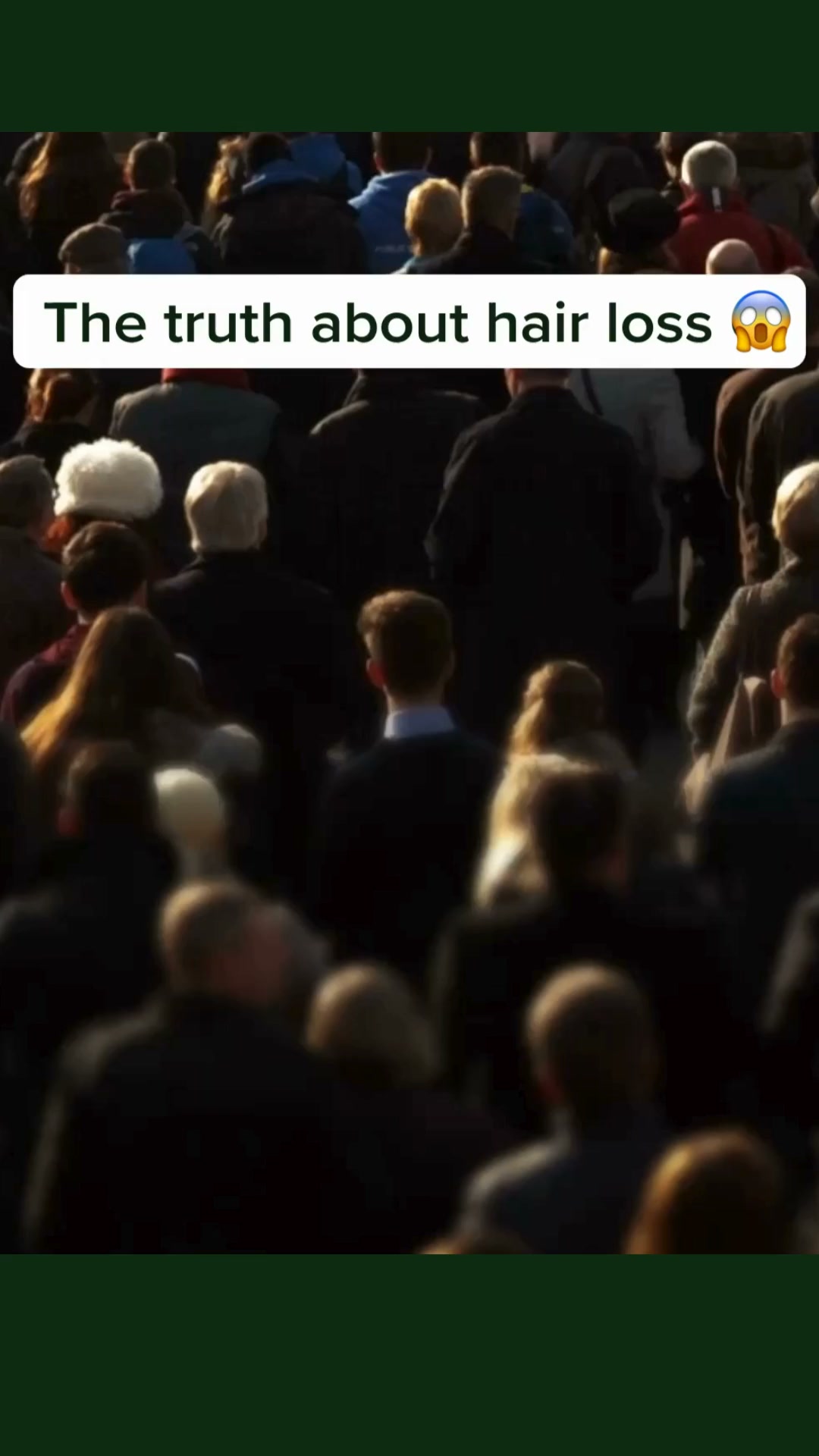 Scandinavian Biolabs Facebook ad: Science-based hair growth solution