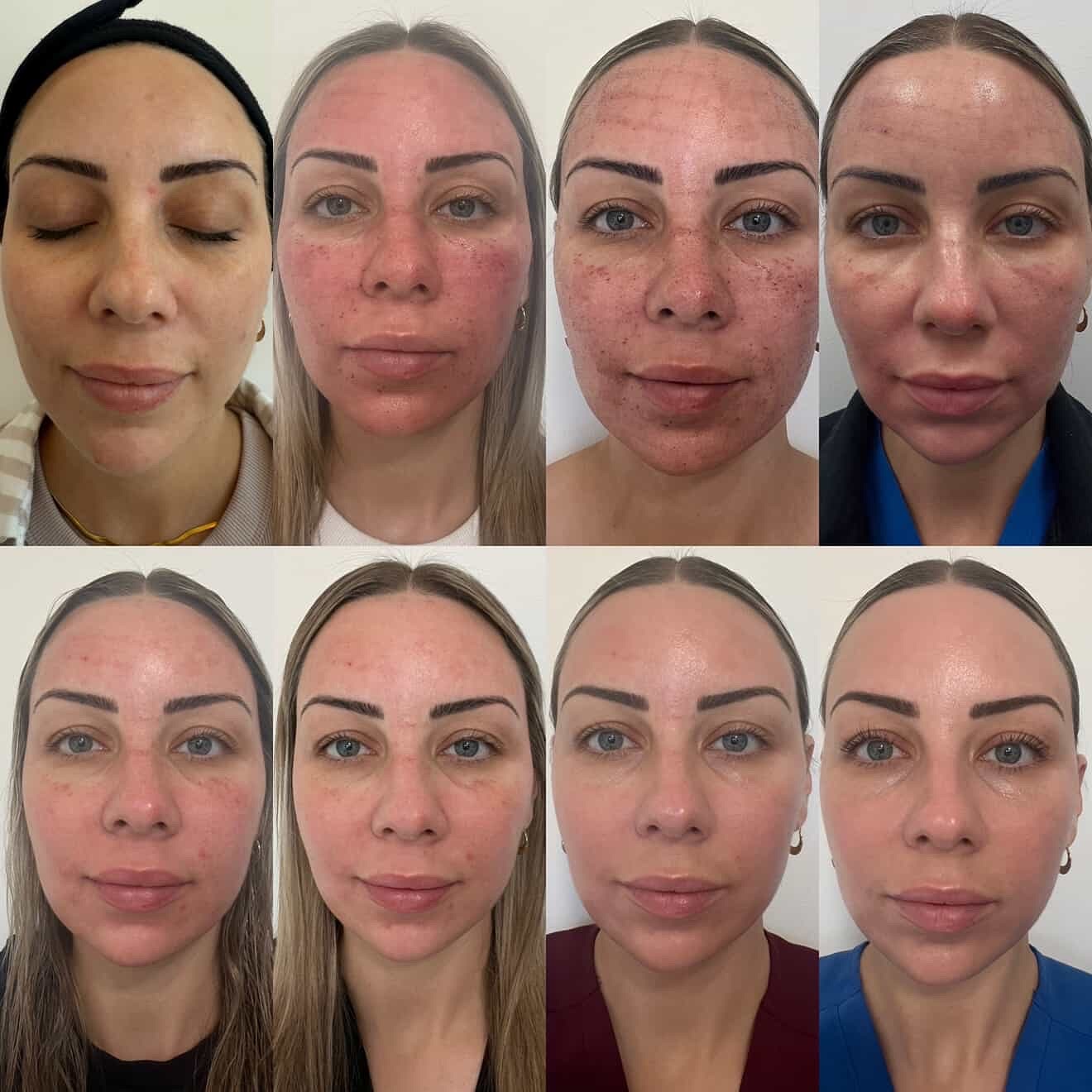 Age Reversal Clinic Facebook ad: Book Your Consultation Today