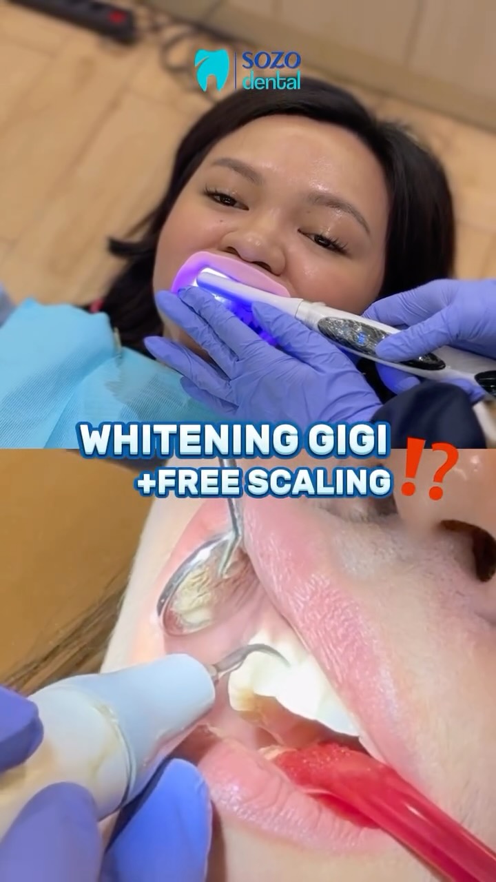 Sozo Dental Clinic Facebook ad: Sekali treatment, gigi langsung putih dan bersih!