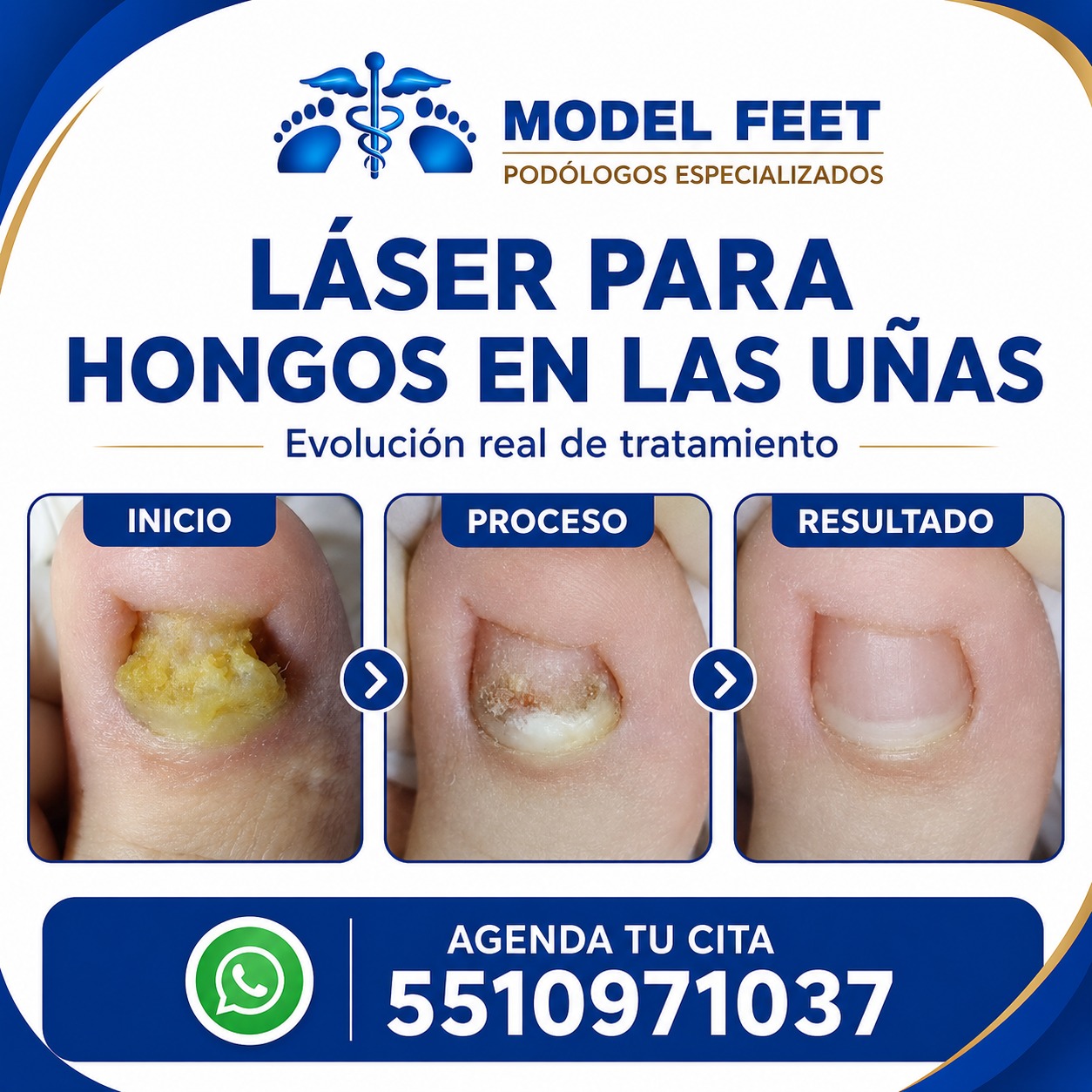 MODEL FEET oficial Facebook ad: Agendar