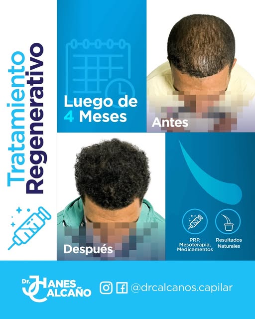 Dr. Jhanes Calcaño Facebook ad