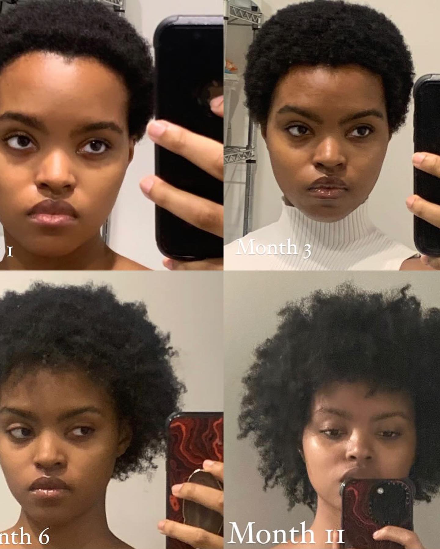 Hair Growth Company Facebook ad: My Results Using The 10 in 1 Hair…