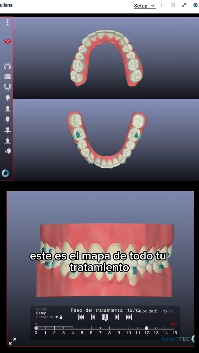 Camila Valencia Odontología Digital Y Miofuncional Facebook ad: ¿Buscas estética, comodidad y resultados predecibles?