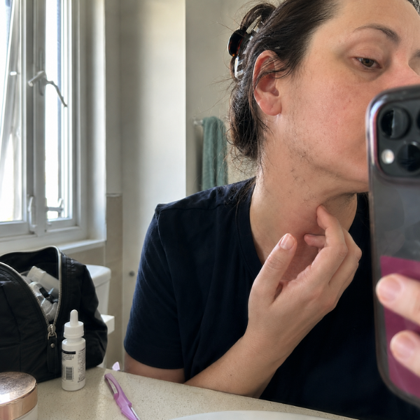 Dana Mercer Facebook ad: Minoxidil was never aimed at what's shrinking your…