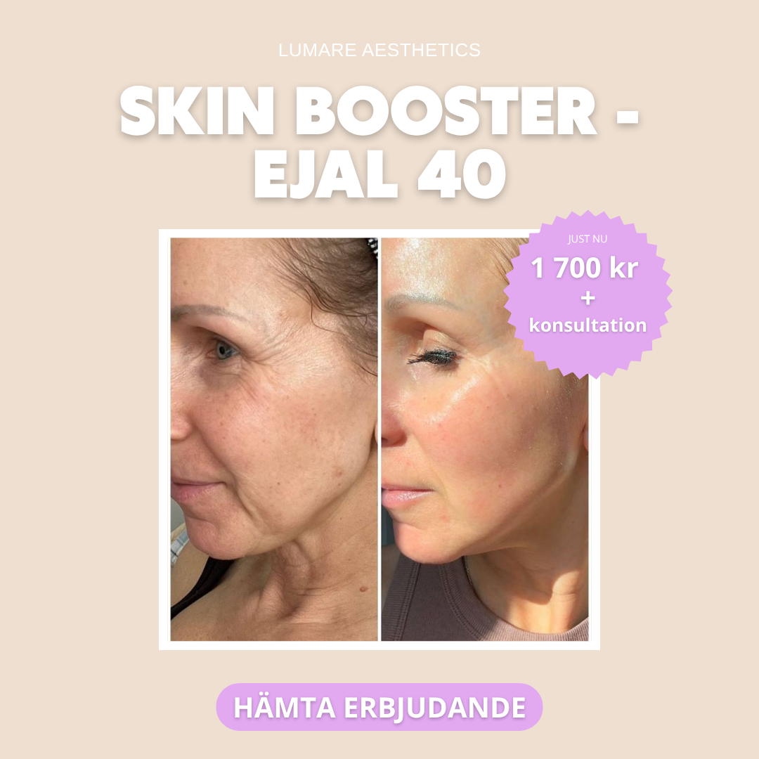 Lumaré Medical Aesthetics Facebook ad: Hud som strålar, Skinbooster gör underverk!