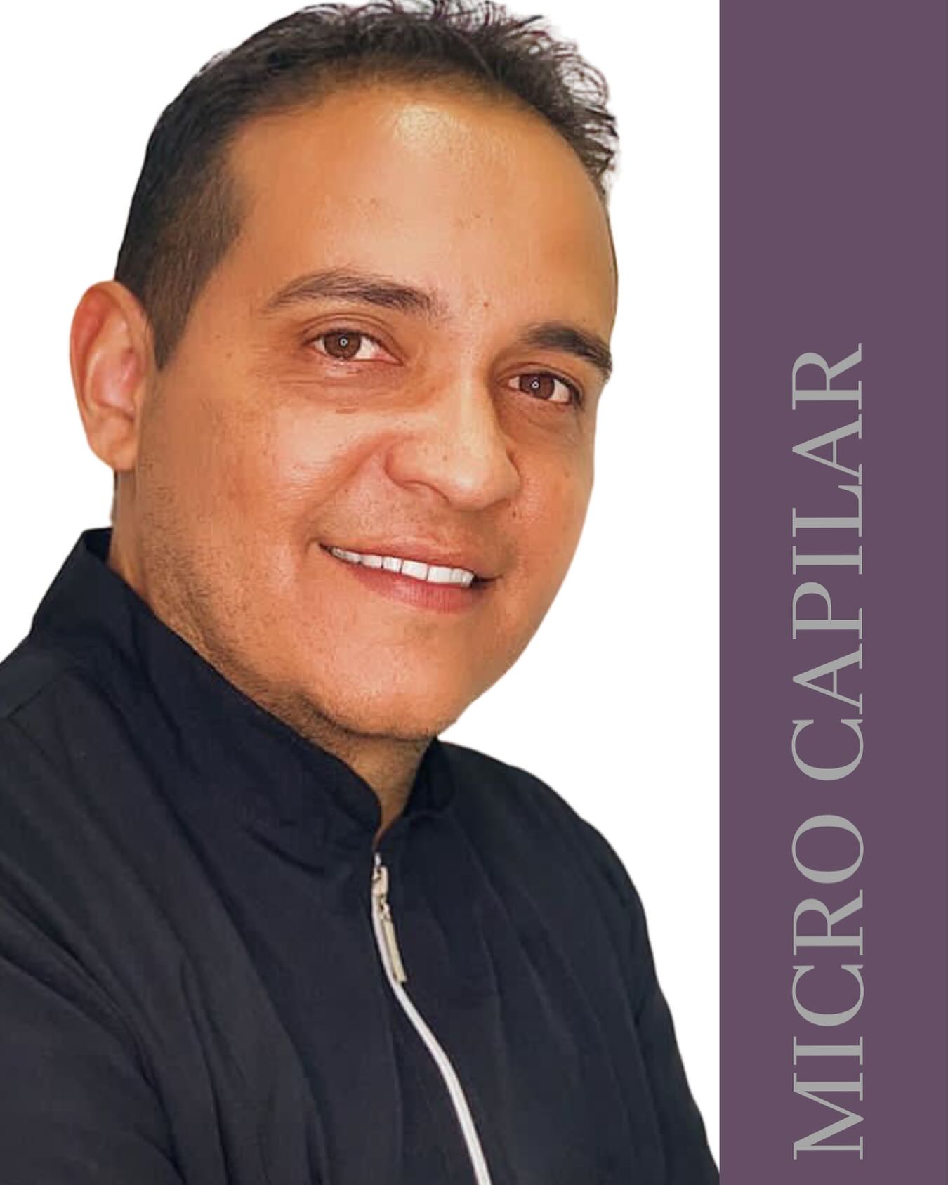 vagnermicrocapilar Facebook ad: A micropigmentação capilar é uma técnica estética que…