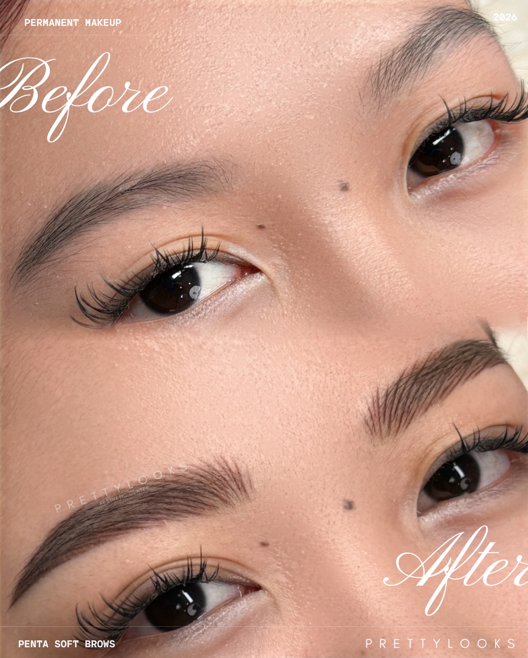 Prettylooks Facebook ad: Before: soft, sparse, barely there.