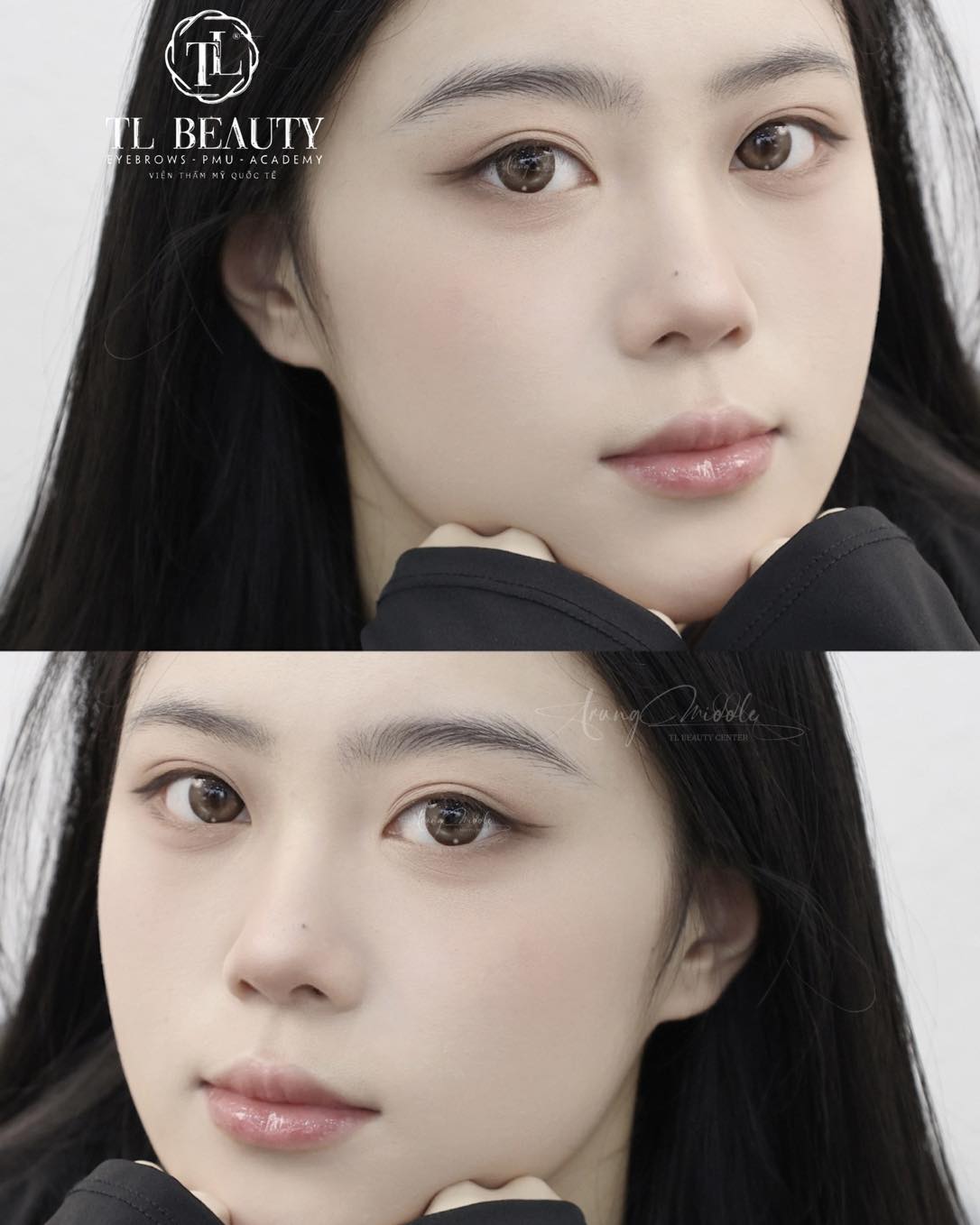 Trung Middle - TL Beauty Center Facebook ad