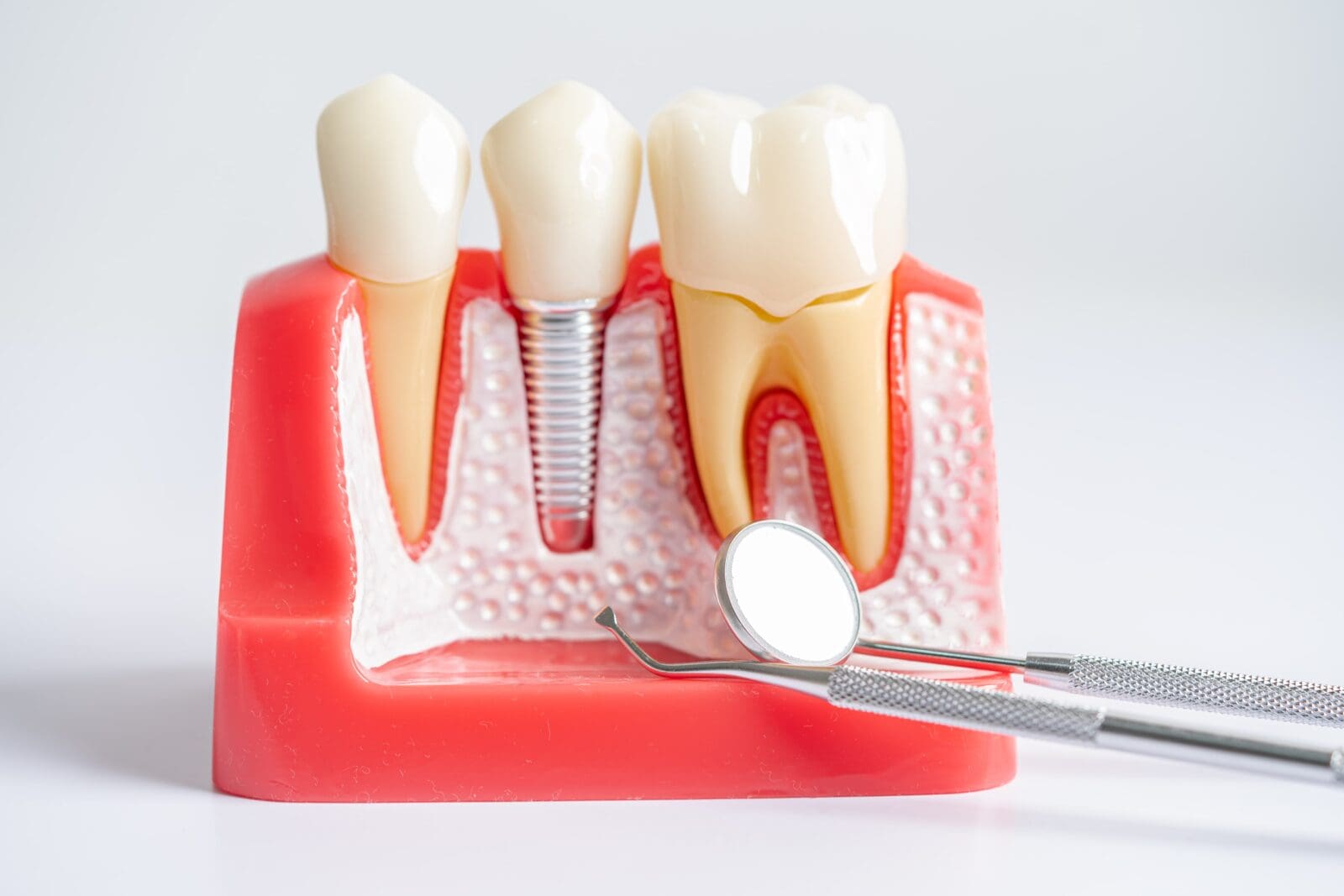 Springborough Endodontics Facebook ad: Specialized Dental Care - Calming, Precise, and Human
