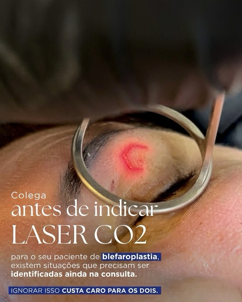 Blefaroplastia Híbrida Facebook ad: Nem todo paciente de blefaroplastia é um bom…