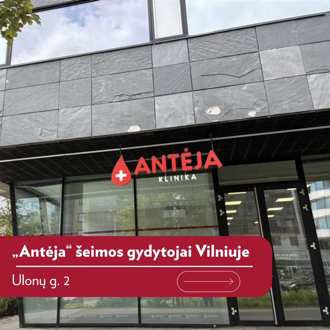 Antėja Facebook ad