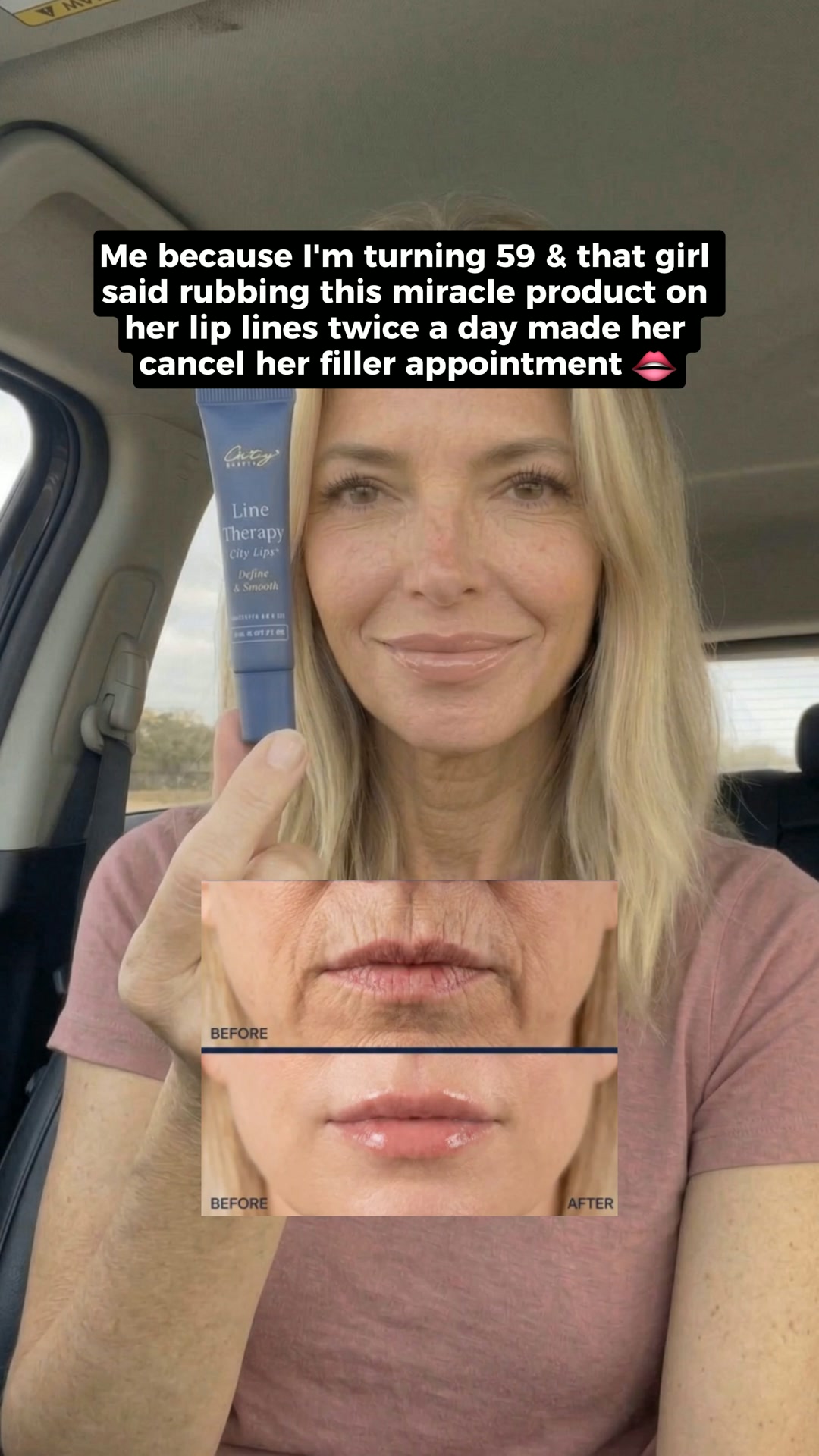 City Beauty Facebook ad: Cancel the Filler Appointment