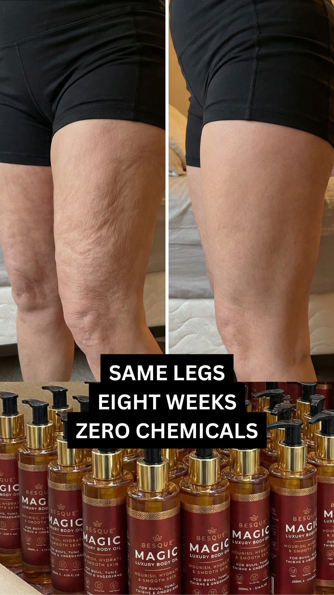40 Plus & Fabulous Facebook ad: Too embarrassed to wear shorts?