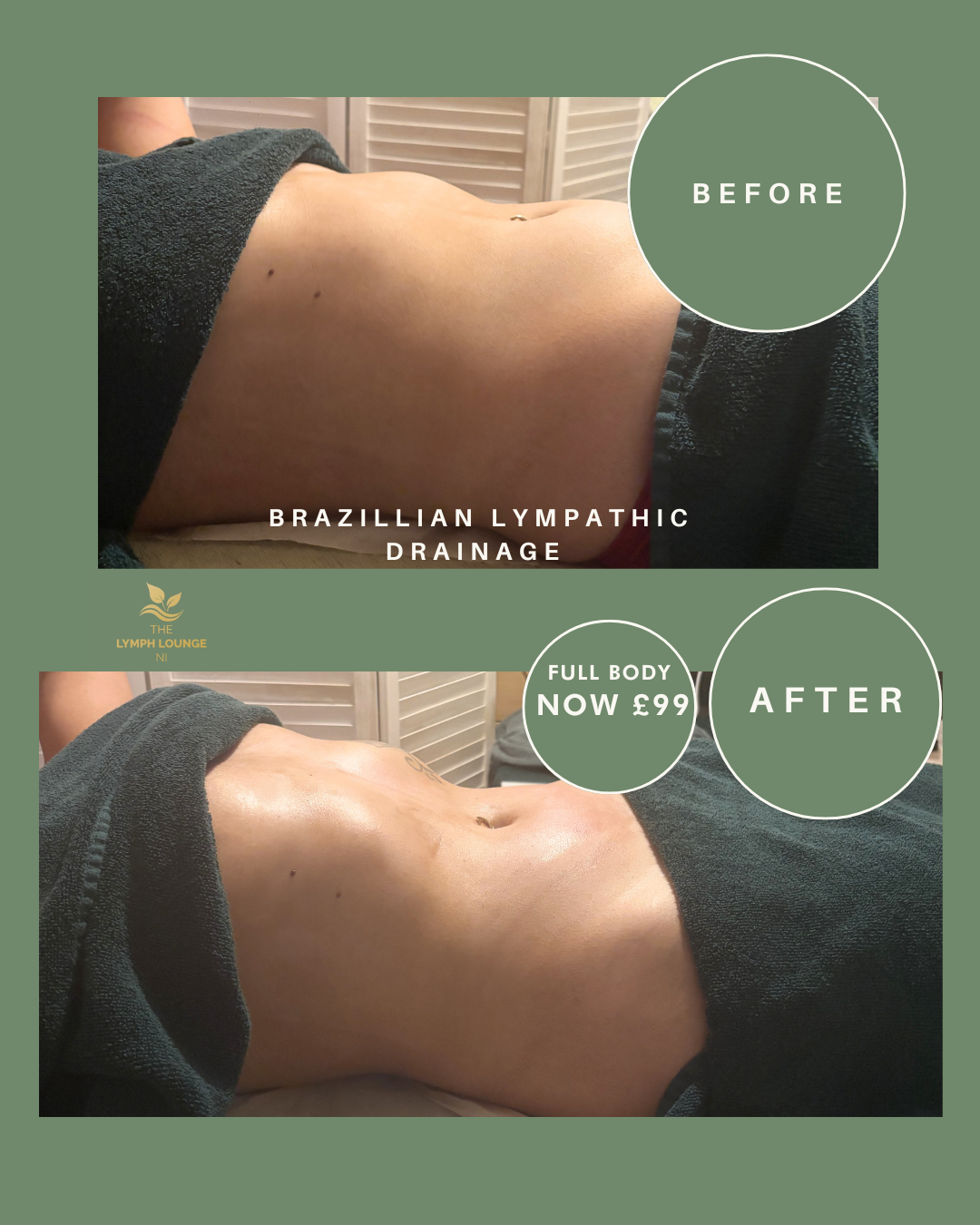 The Lymph Lounge NI Facebook ad: Only £99- Full Body with wood tools, including face