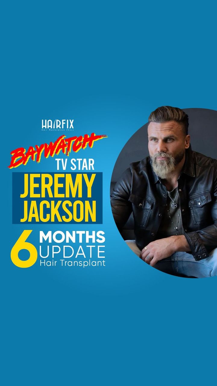Hairfix Facebook ad: Here’s the so-waited part 3 of @jeremyjacksonfitness hair…