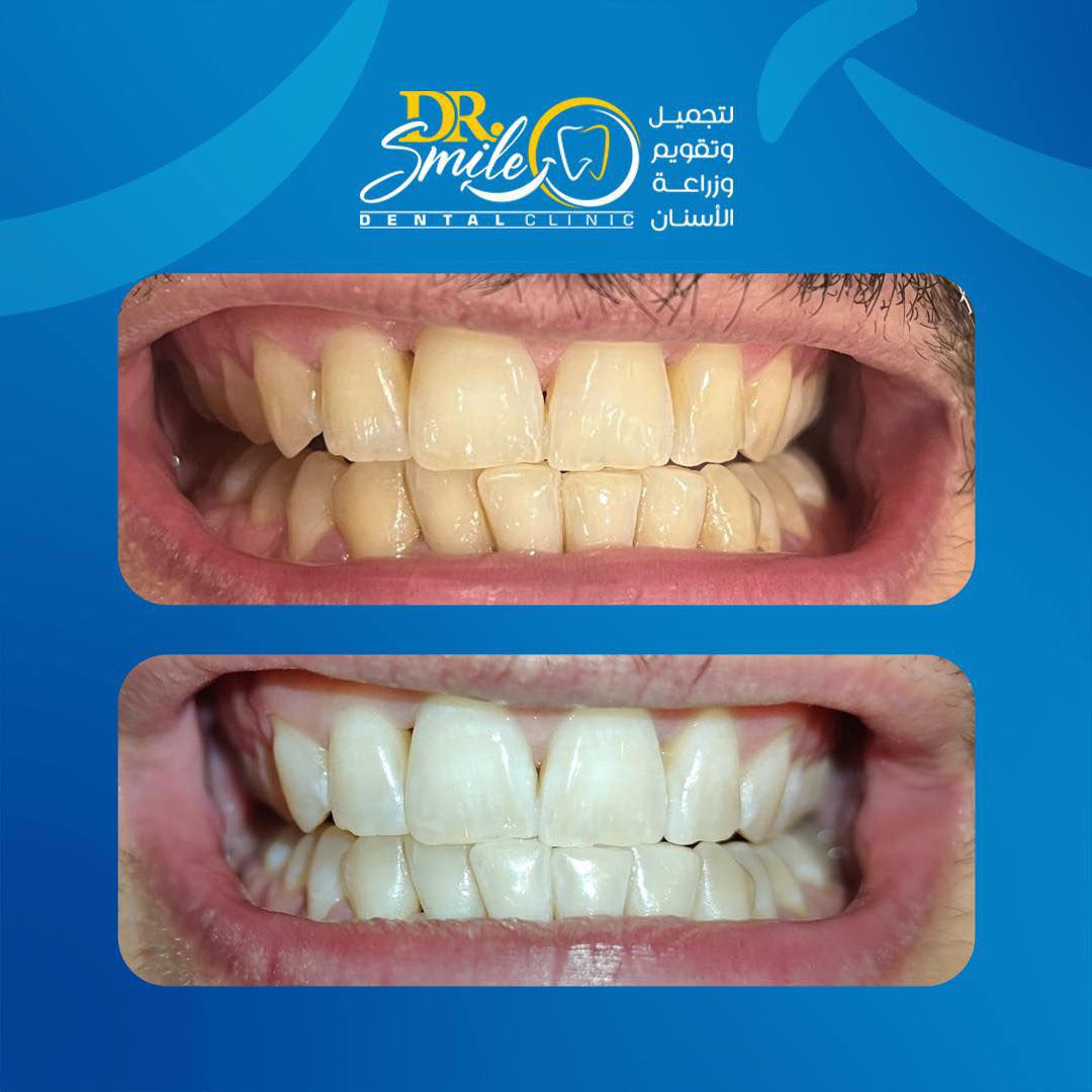Dr.Smile Dental Clinic - لزراعة وتجميل الأسنان Facebook ad