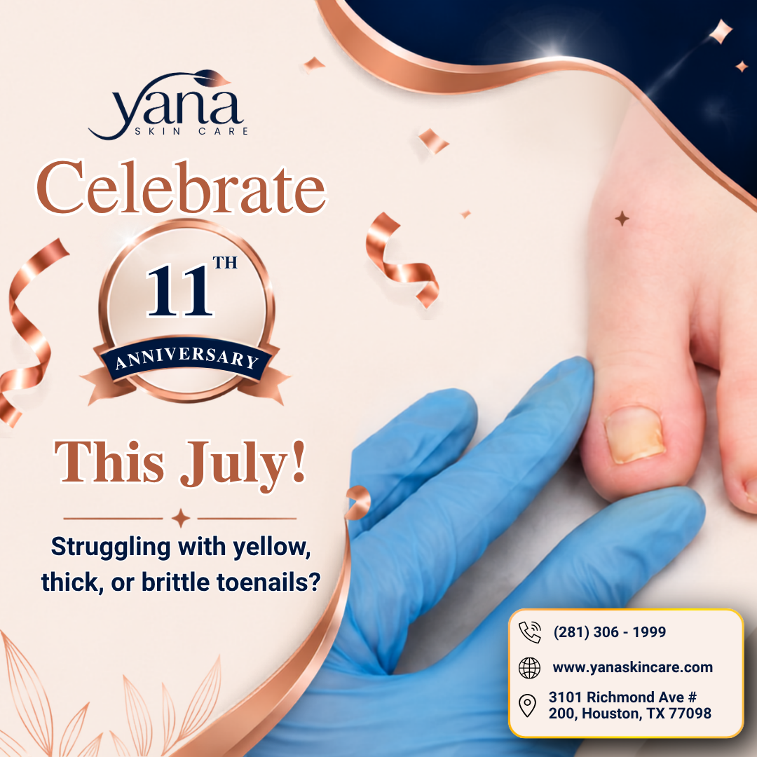 Yana Skin Care Facebook ad: 11th Anniversary July Special: Toe Nail Fungus Treatment…