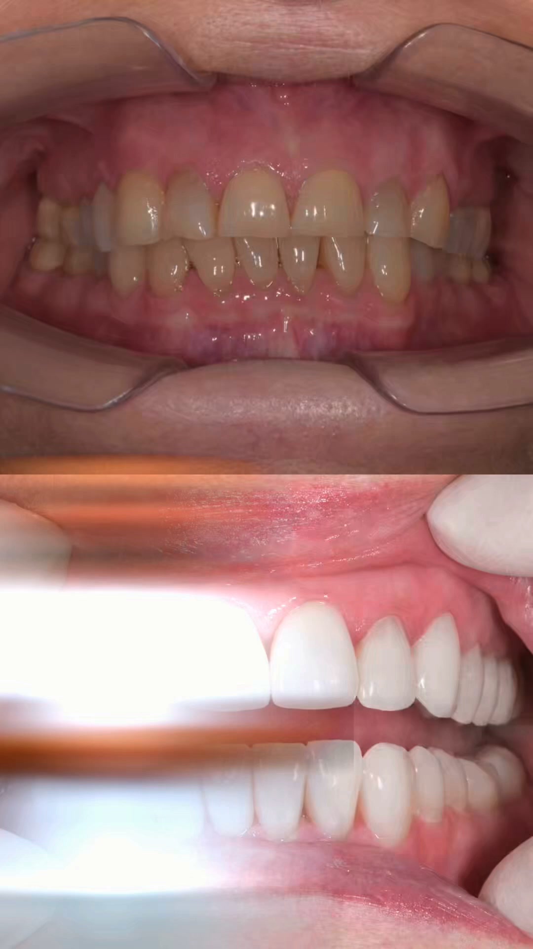 Lotus dentalni center Facebook ad: Včasih preobrazba nasmeha pomeni povrniti tisto, kar je…