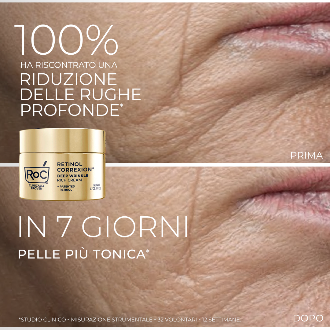 RoC Skincare Italia Facebook ad from Feb 26, 2026