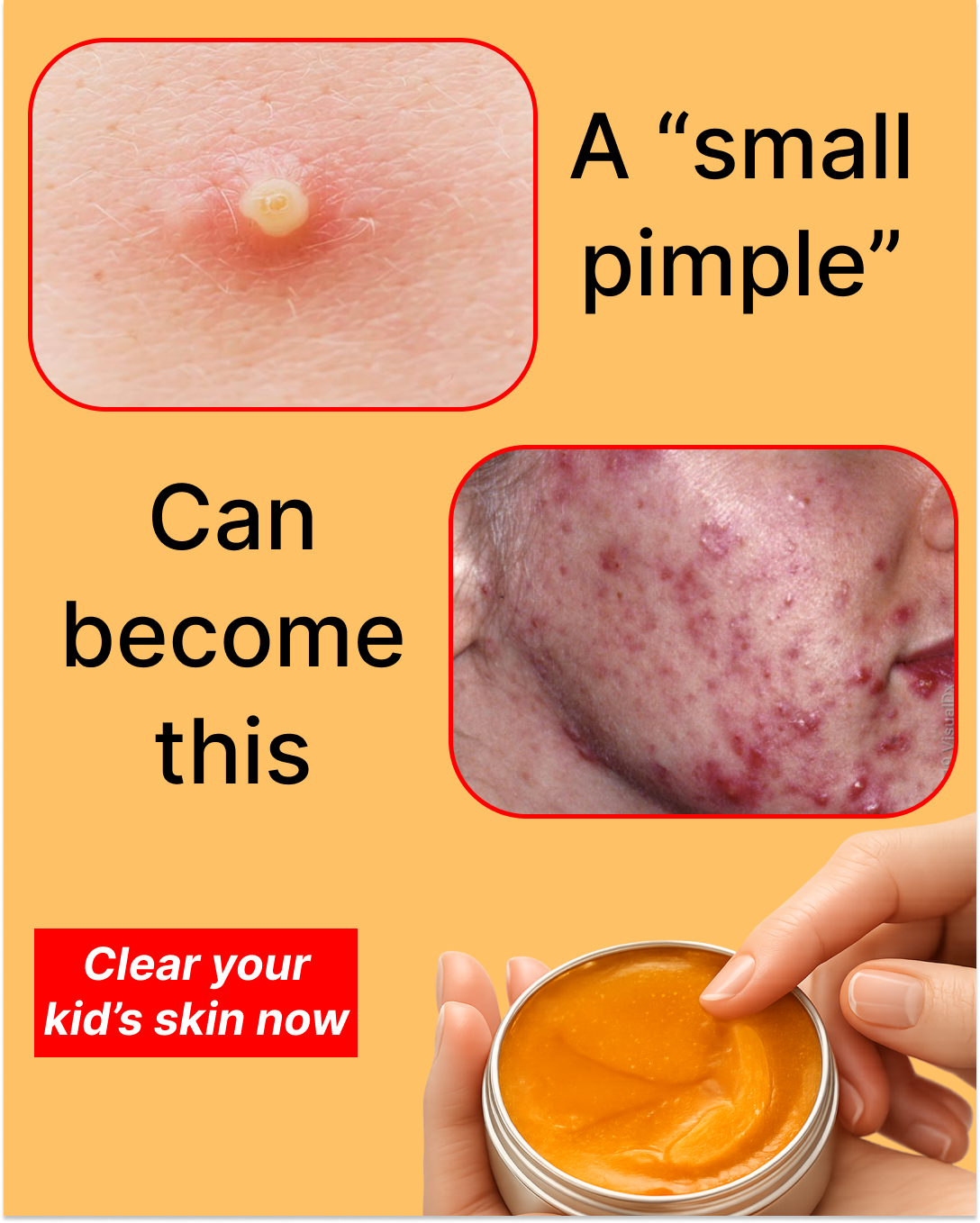 Dr. Susan Facebook ad