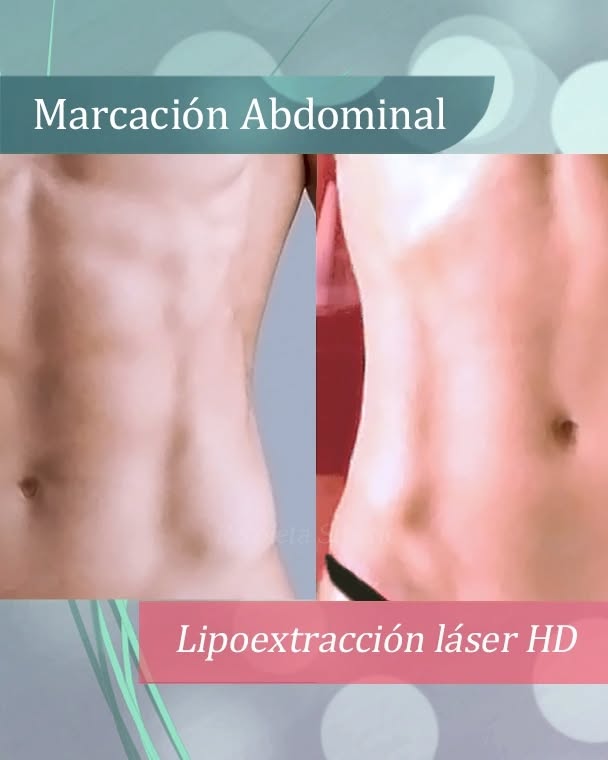 Recoleta Sthetic Facebook ad