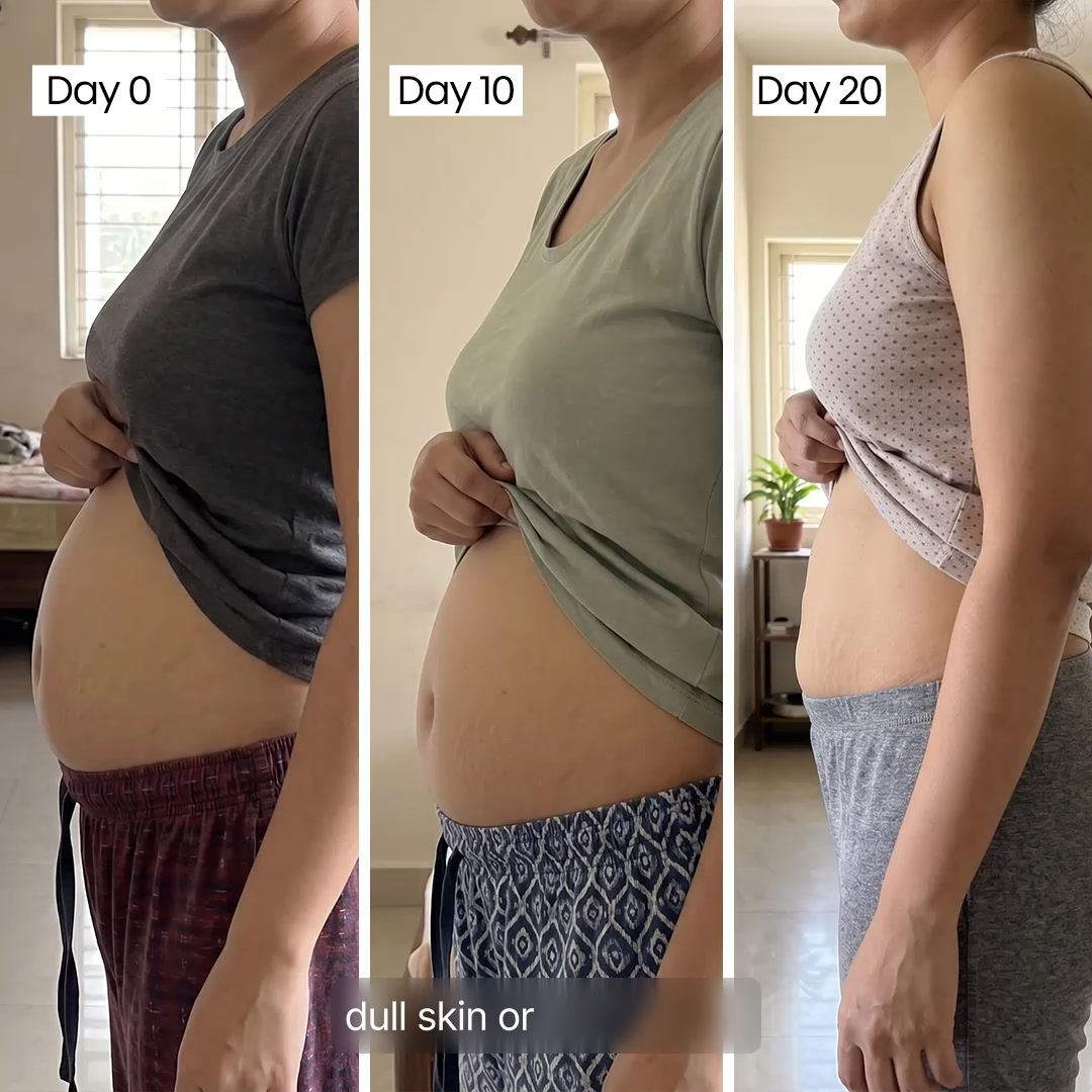 Indulgeo.essentials Facebook ad: Navel patches for gut + detox support