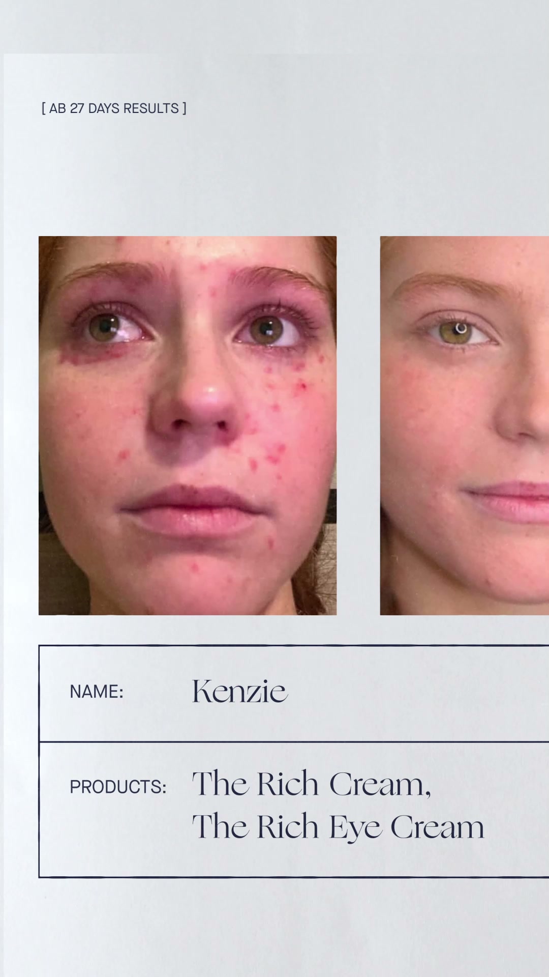 Augustinus Bader Facebook ad: A beauty phenomenon - The Rich Cream