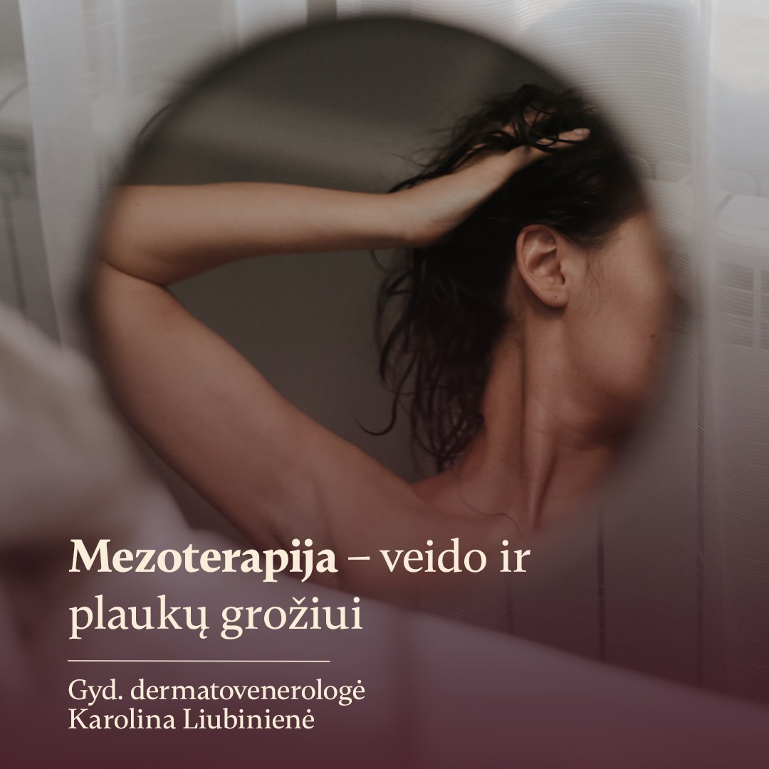 InSense Clinic Facebook ad: Kai odai ir plaukams prireikia papildomo rūpesčio…