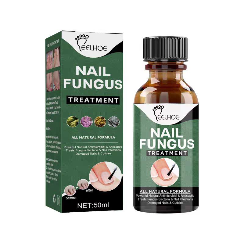 Top online shopping Facebook ad: Serum protiv gljivica na noktima, prirodna formula za…