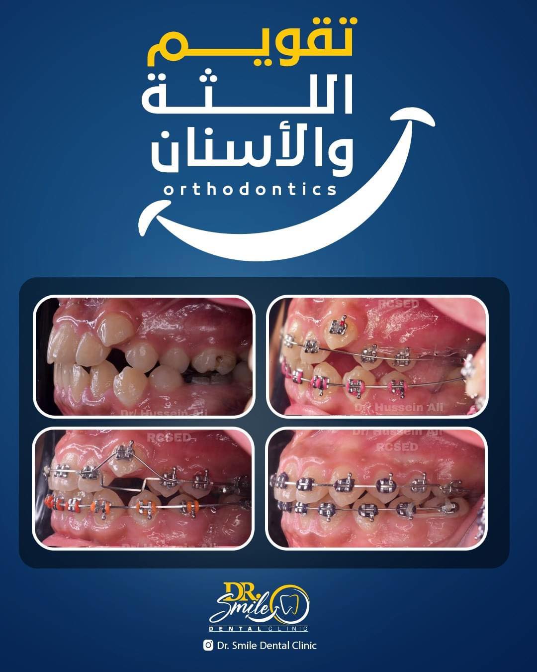 Dr.Smile Dental Clinic - لزراعة وتجميل الأسنان Facebook ad