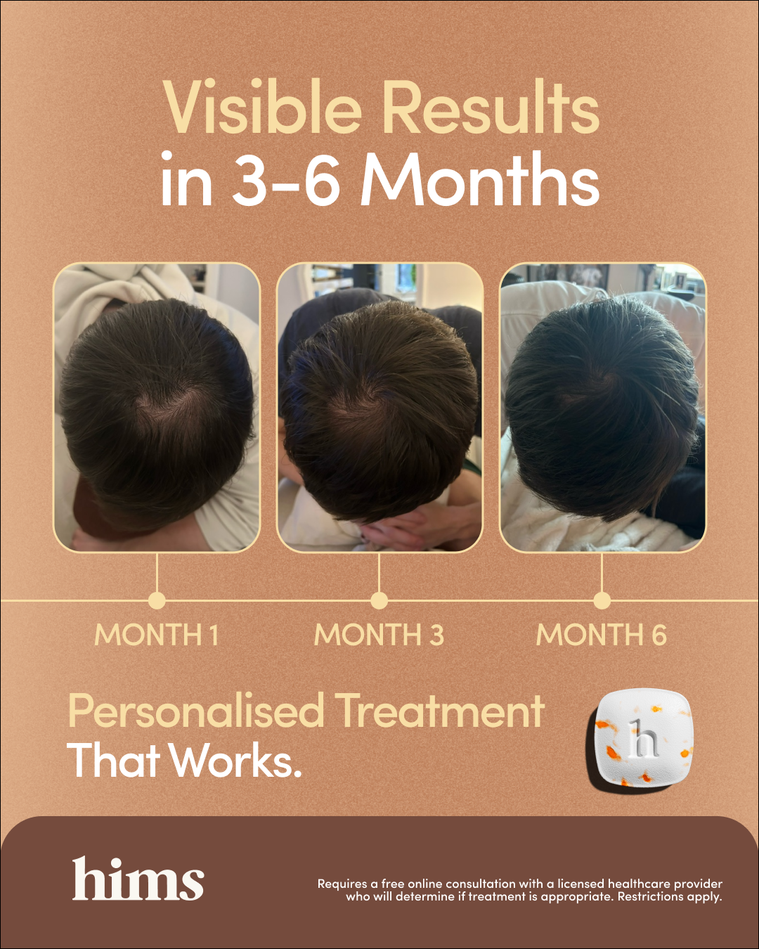 hims Facebook ad