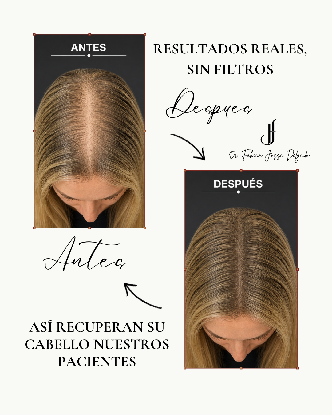 Dr. Fabian Jossa Facebook ad: Recupera tu cabello a tiempo