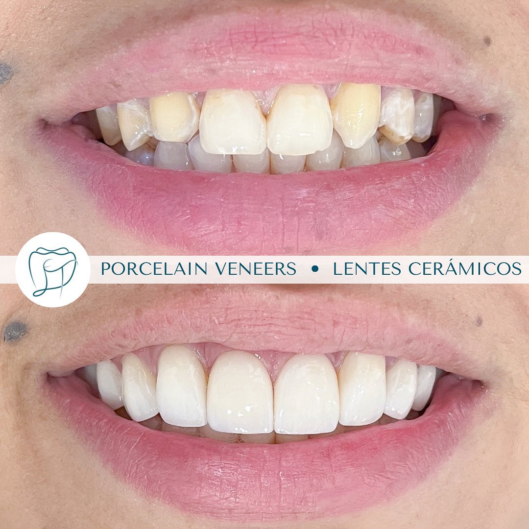 LET Dental Studio Facebook ad: Te ofrecemos nuestro innovador servicio de micro diseños…