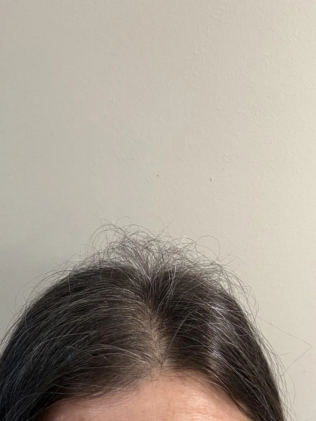 Olivia Brown Facebook ad: Read this if your hair loss is scaring you lately