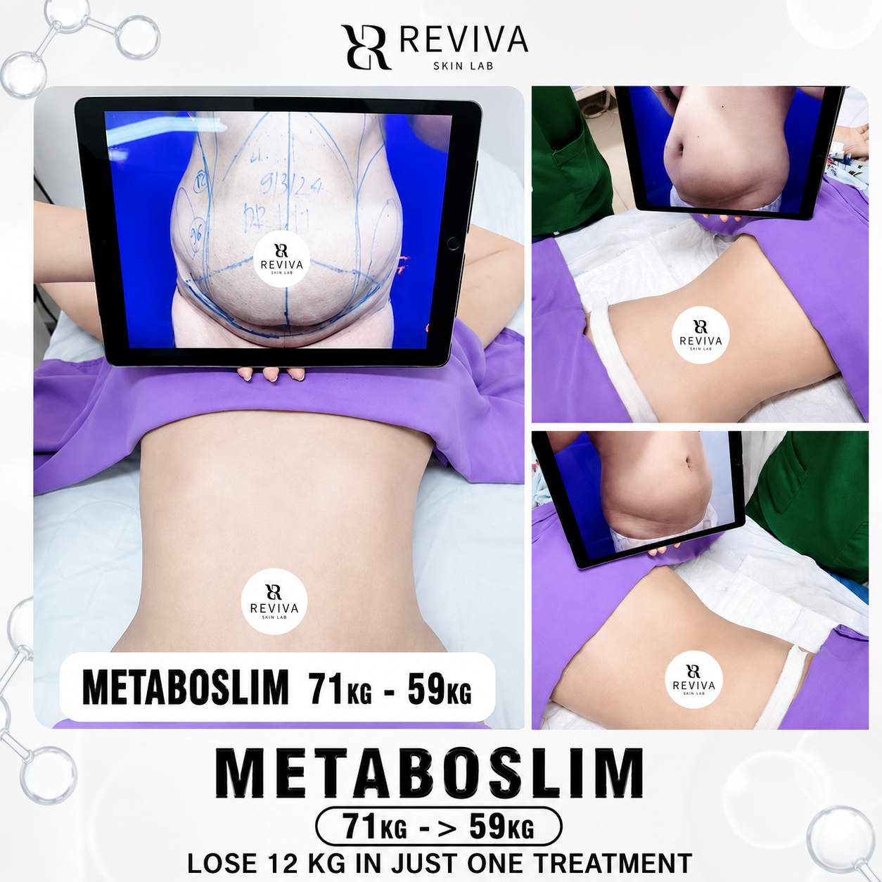 Reviva Aesthetic & Beauty Clinic - Iloilo Branch Facebook ad: Discount 40% First 10 Customers Only