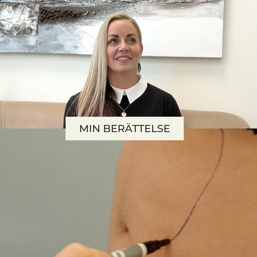 Estetikcentrum Facebook ad
