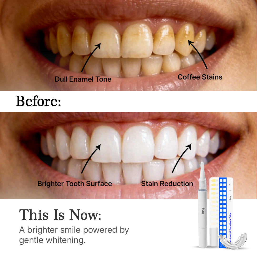 Smile Care Club Facebook ad