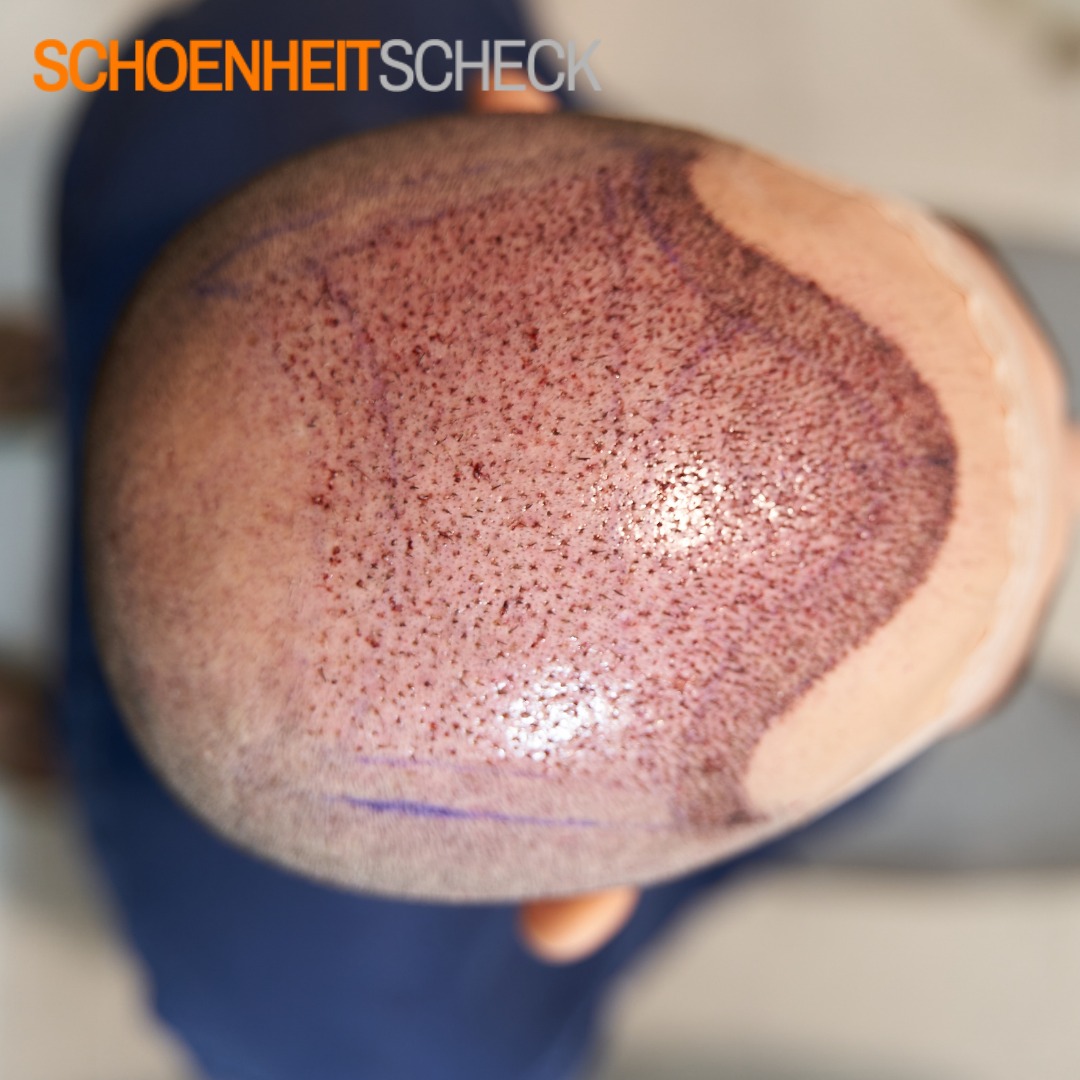 Schoenheitscheck Germany Facebook ad: Haarausfall? Die Lösung ist näher als Sie denken!