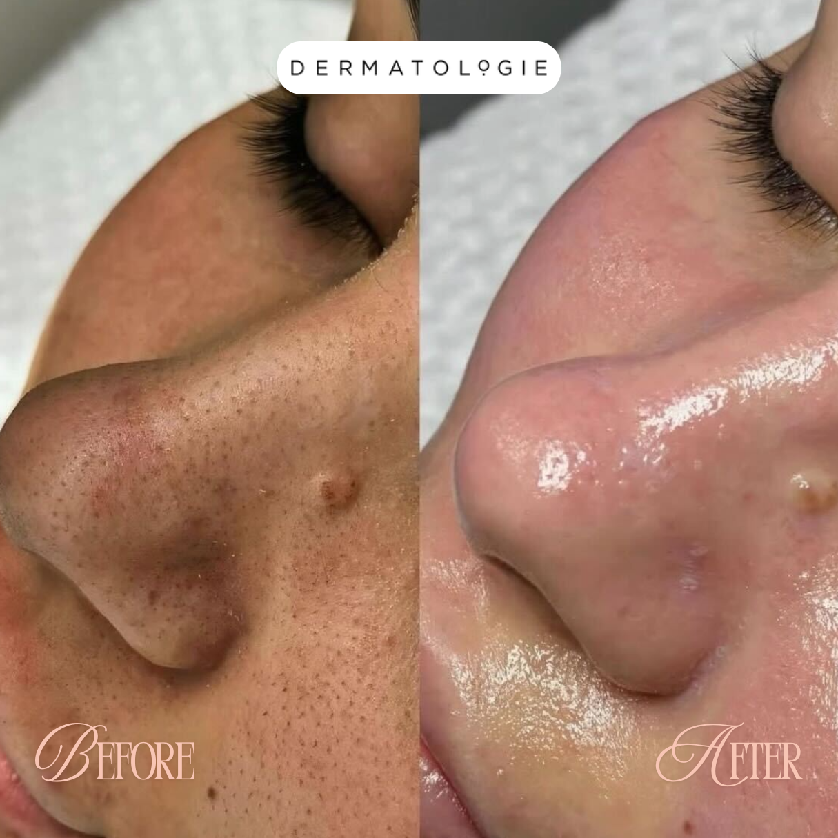 Dermatologie Skin + Hair Solutions Facebook ad: Get Fresh, Glowing Skin With Our $199 Signature HydraFacial