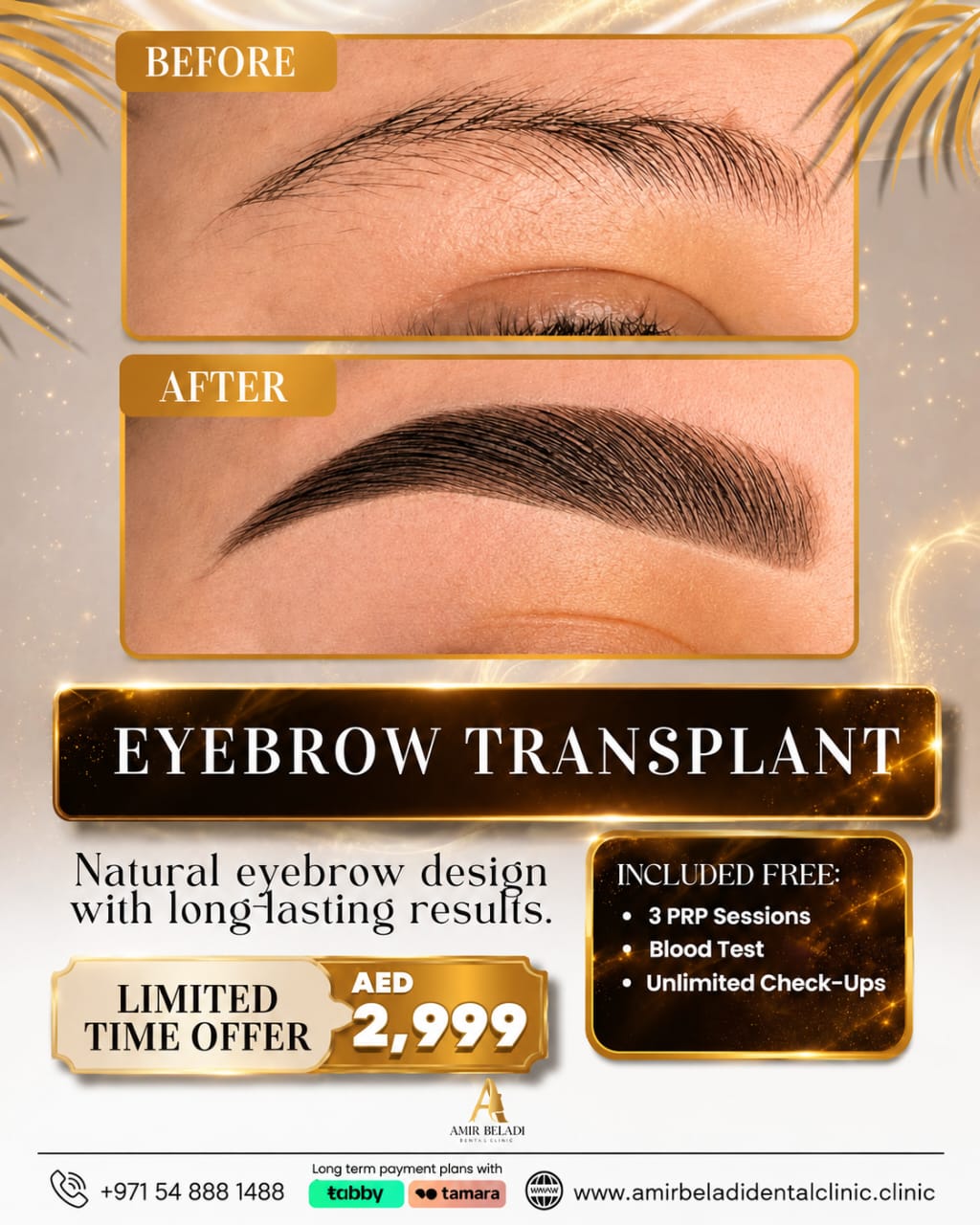 Amir Beladi Polyclinic Facebook ad: That after is not makeup.