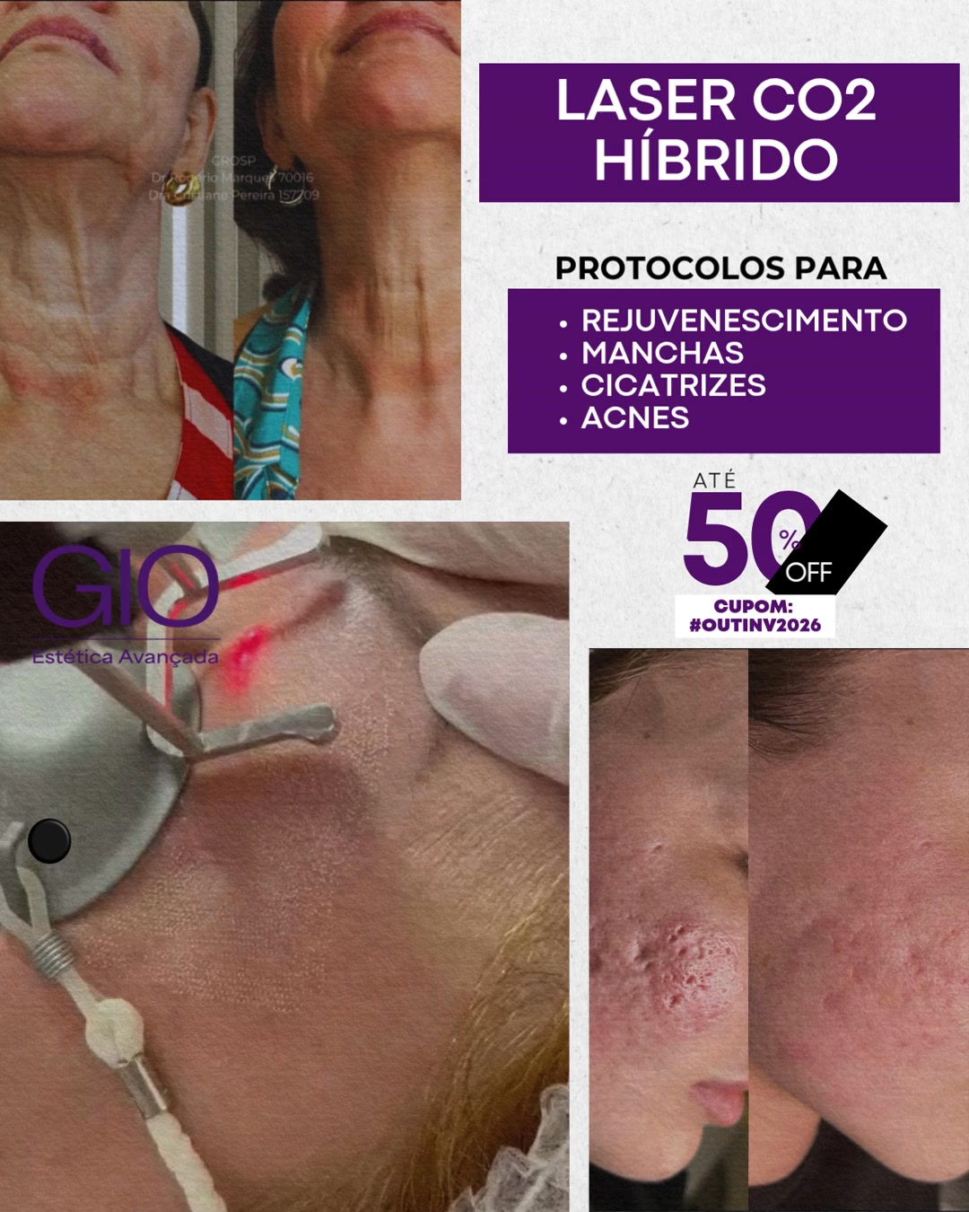 GiO Estética Avançada Litoral Facebook ad: Renove sua pele com tecnologia