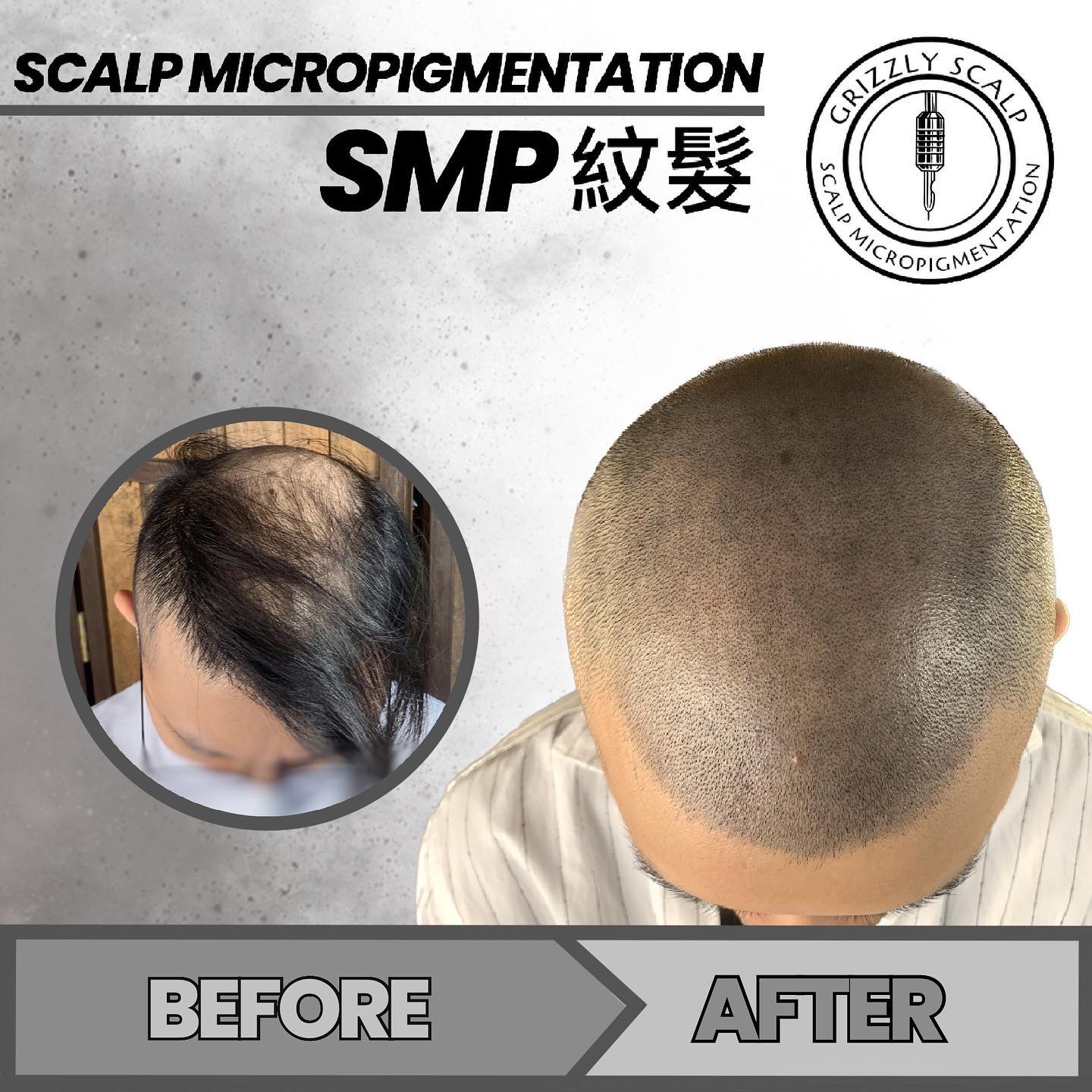 Grizzly Scalp 紋髮 Bob Ng Facebook ad