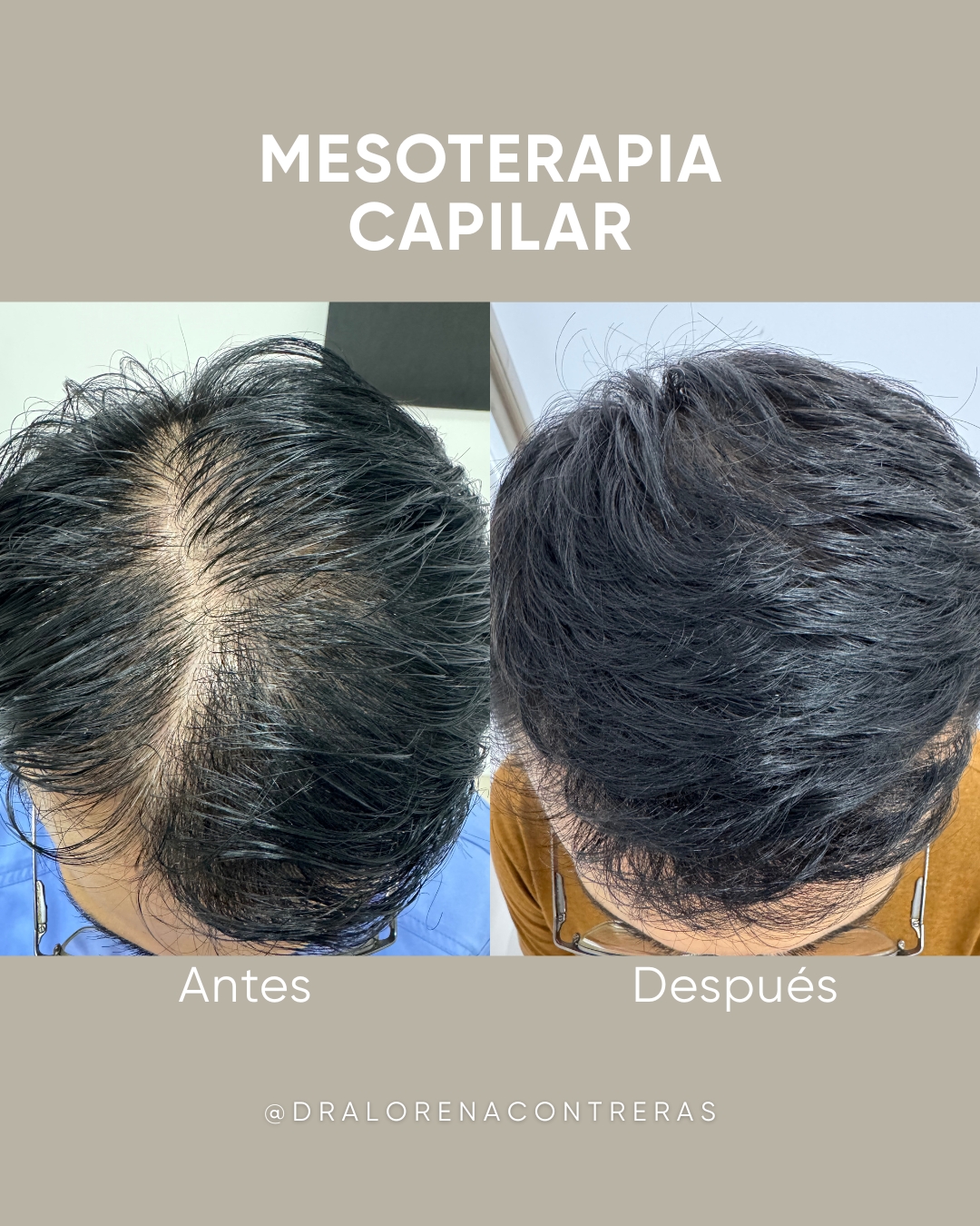 Dralorenacontreras Facebook ad: ¿Te estás quedando sin cabello y no sabes…