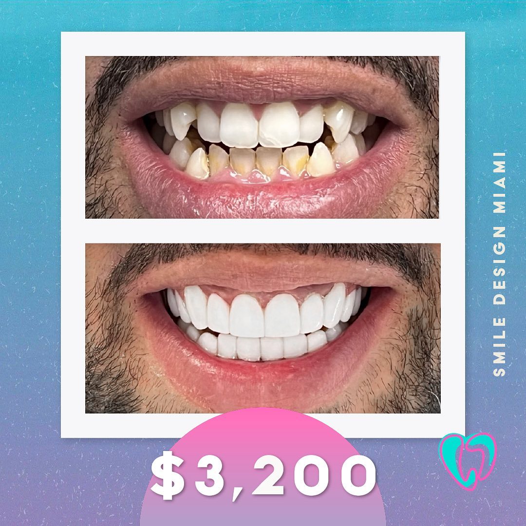 Smile Design Mia Facebook ad