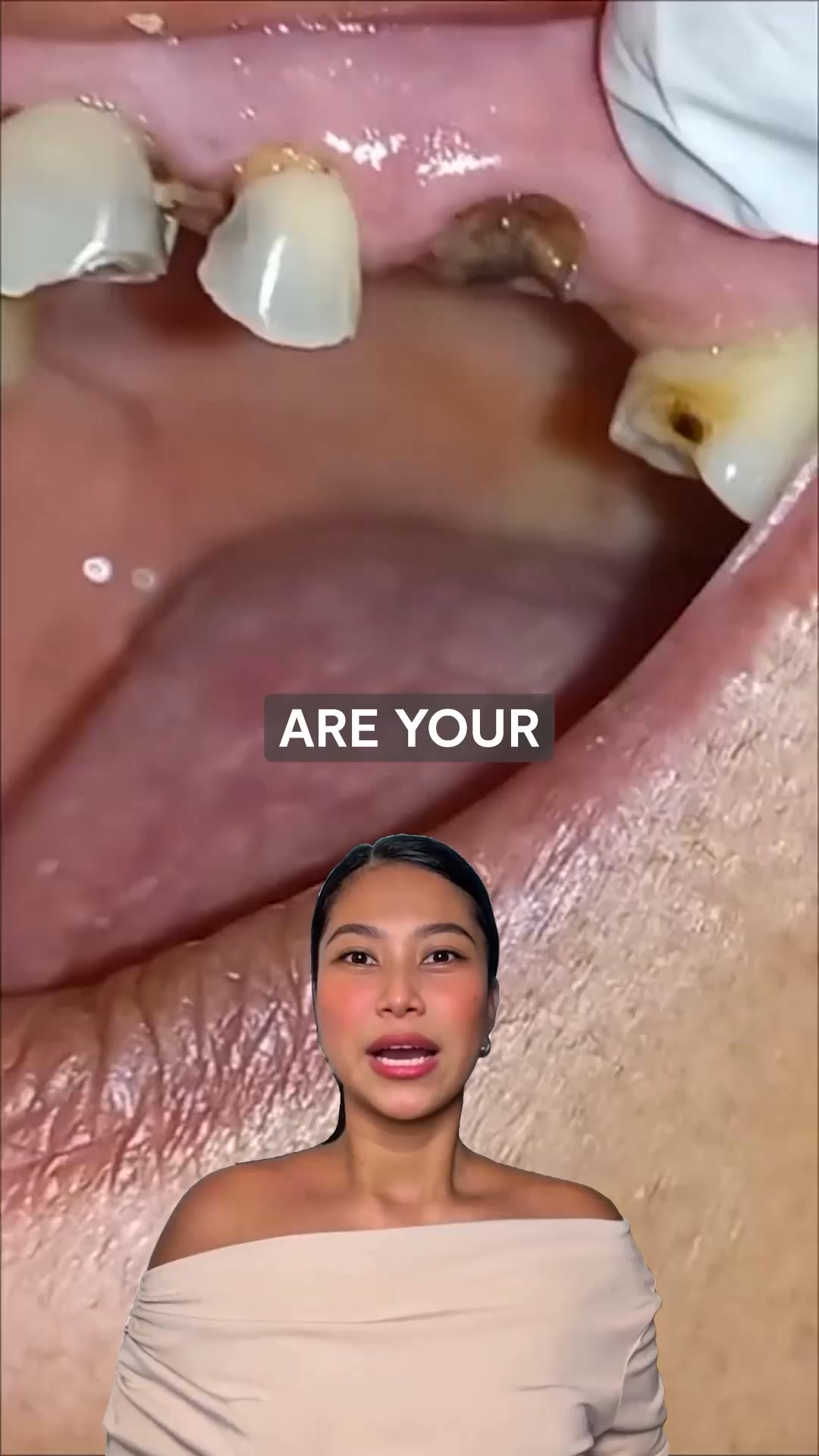 Fenton Family Dental Facebook ad: FREE Dental Implants Consultation + CT Scan