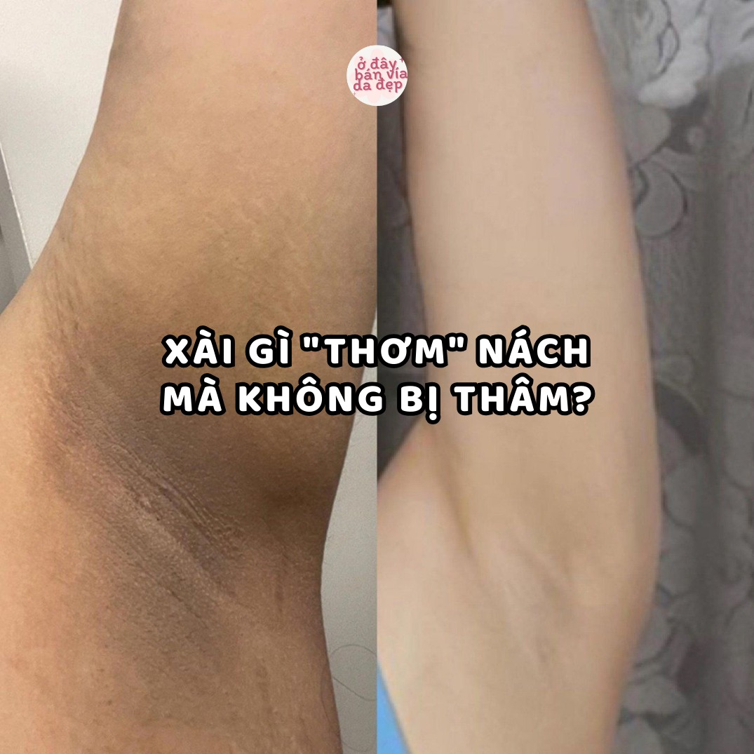 Ở đây bán vía da đẹp Facebook ad: XÀI GÌ THƠM NÁCH MÀ KHÔNG BỊ THÂM?