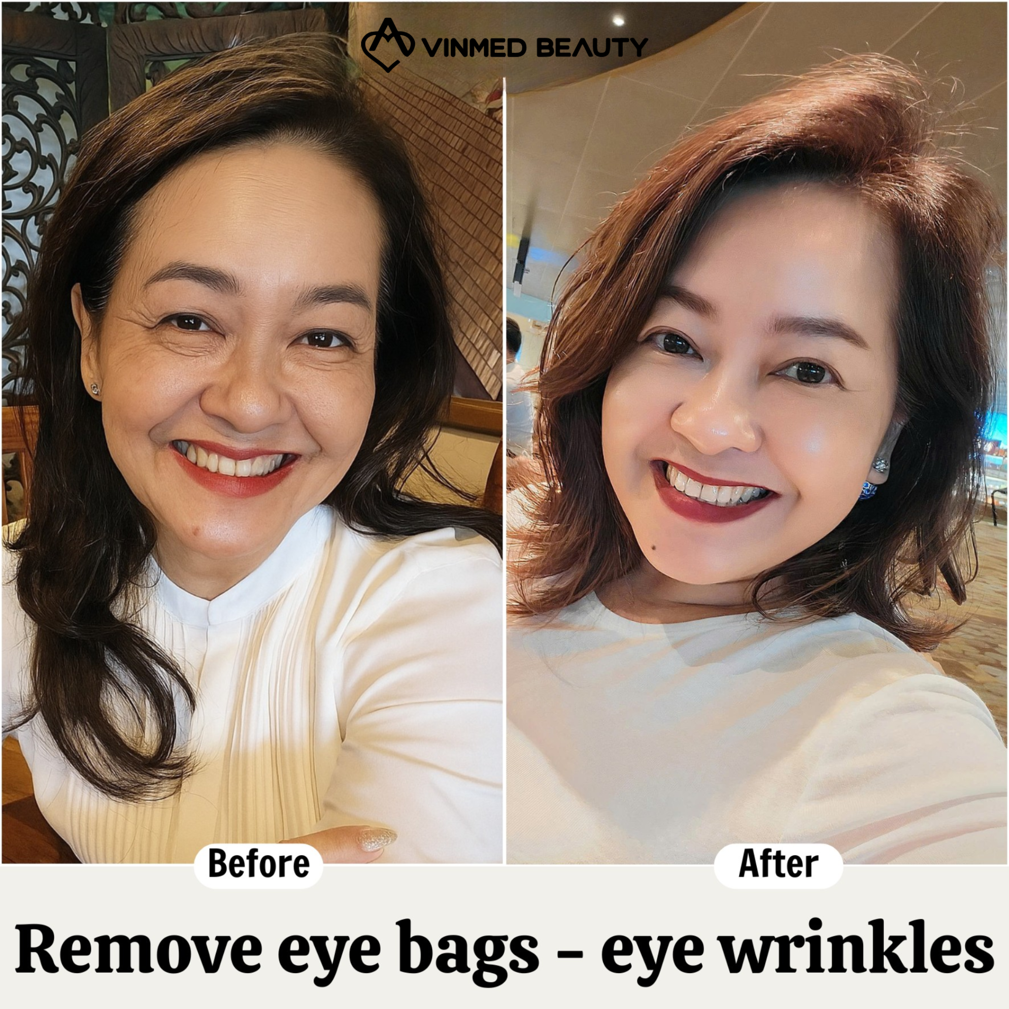 Vinmed Beauty - No. 1 Dermatology salon in Dubai Facebook ad