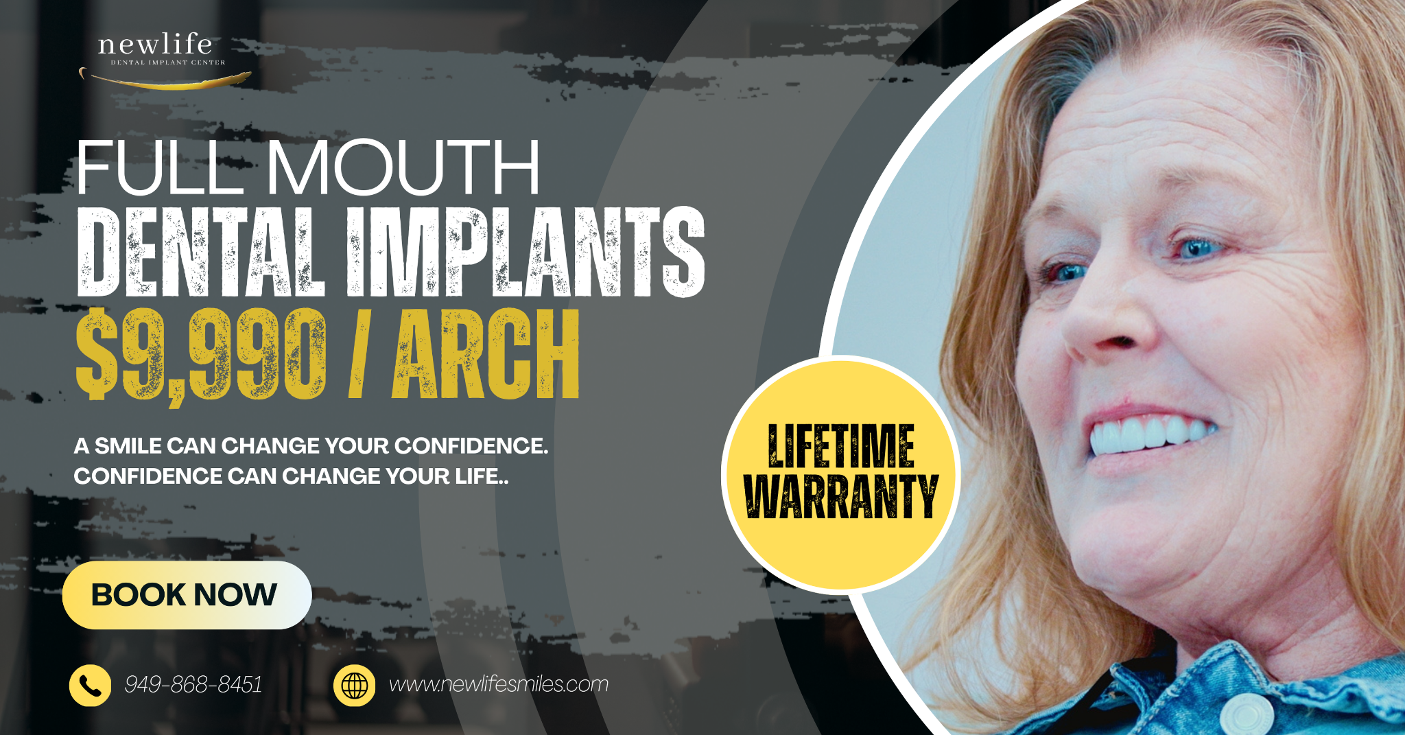 New Life Implant Center Facebook ad: Full Mouth Implants in Temecula, CA